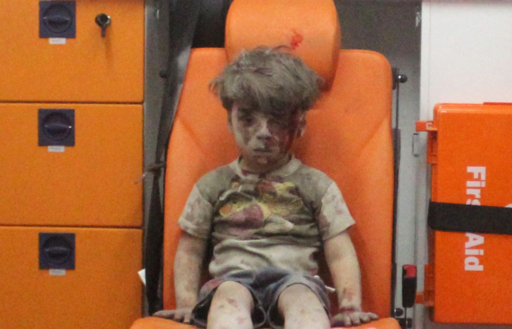 Ο μεγαλύτερος αδελφός του μικρού Ομράν, υπέκυψε στα τραύματά του στο Χαλέπι
