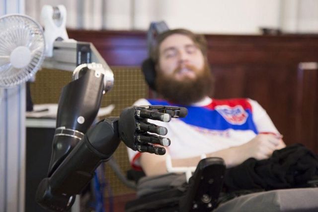 Ρομποτικό χέρι «έδωσε πίσω» αίσθηση αφής σε 28χρονο