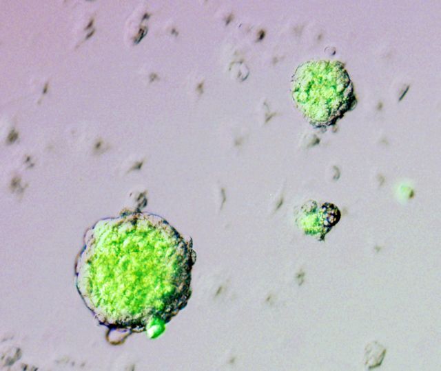 Χοίροι με ανθρώπινο DNA υπόσχονται όργανα για μεταμόσχευση
