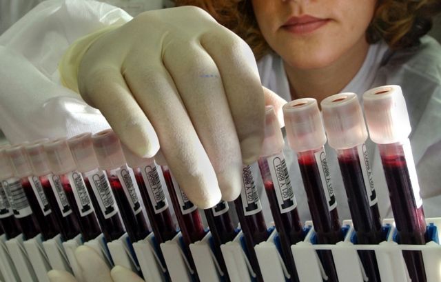 Εξέταση αίματος εντοπίζει νωρίς τον καρκίνο των ωοθηκών