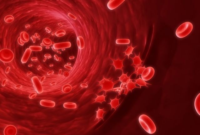 Η ομάδα αίματος επηρεάζει τον κίνδυνο για έμφραγμα