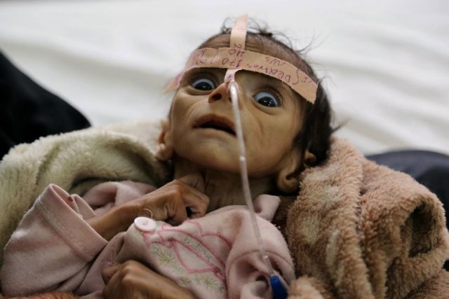 Στοπ στις βόμβες που θερίζουν την Υεμένη