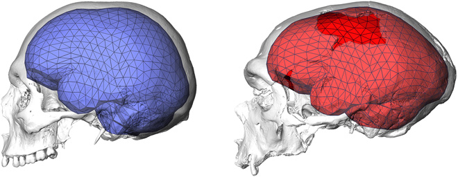 Ο ανθρώπινος εγκέφαλος απέκτησε σφαιρικό σχήμα 100.000 χρόνια πριν