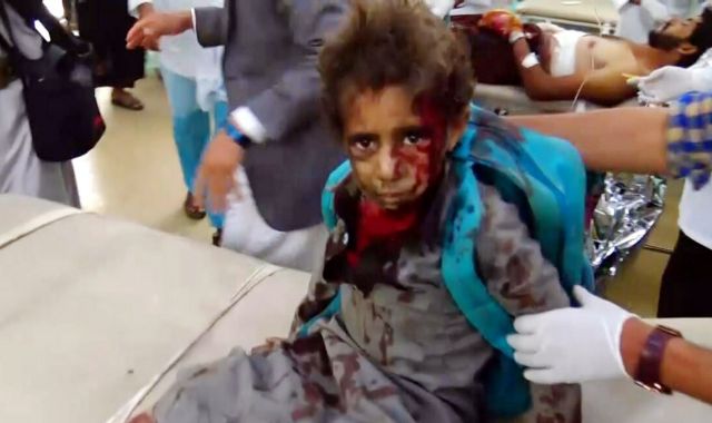 Υεμένη: ΟΗΕ και ΗΠΑ ζητούν έρευνα για τον θάνατο των αμάχων