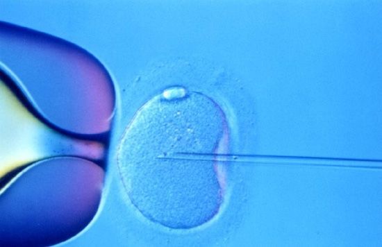 Η εξωσωματική γονιμοποίηση εγκυμονεί επιπλοκές στην κύηση