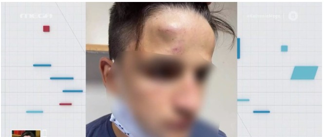 Συμμορία ανηλίκων ξυλοκόπησε άγρια 17χρονο στο Γαλάτσι – Τι λέει η οικογένειά του στο MEGA