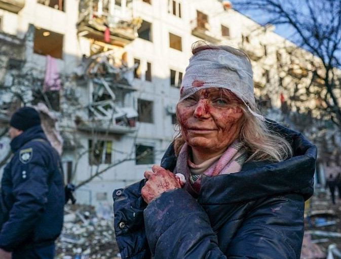 Ουκρανία: H φωτογραφία με την τραυματισμένη που συγκλονίζει τον πλανήτη