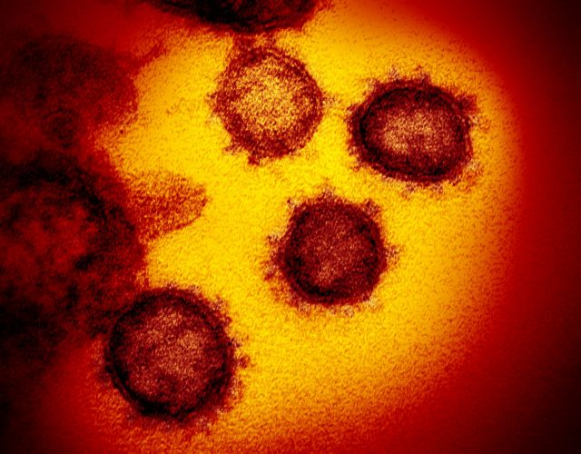 SOS από τους επιστήμονες – Ανακαλύφθηκε υβριδικός ιός που… ξεγλιστρά από τα αντισώματα
