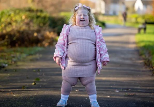 Βρετανία: Η πεντάχρονη που ζυγίζει 45 κιλά και το σύνδρομο που την κάνει να πεινάει