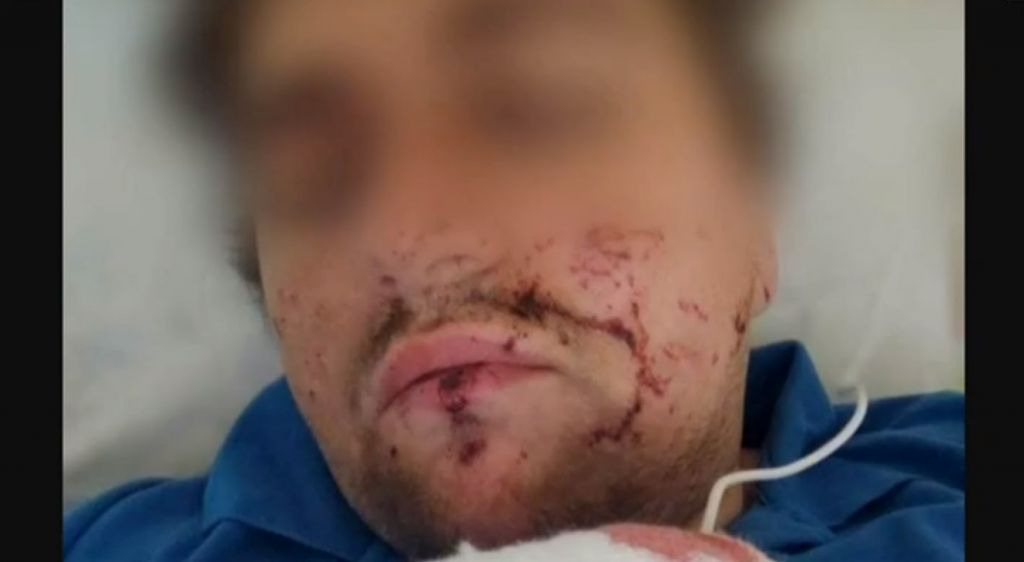 Τραυματίστηκε Έλληνας στρατιώτης που πολεμά στην Ουκρανία