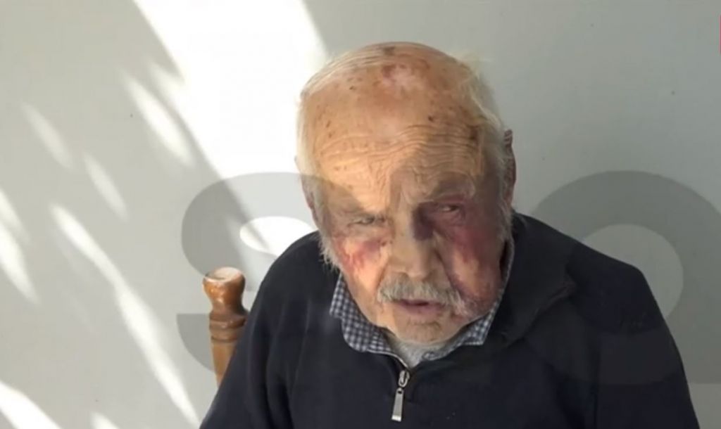 Συγκλονίζει ο 90χρονος που ξυλοκόπησαν ληστές για 80 ευρώ