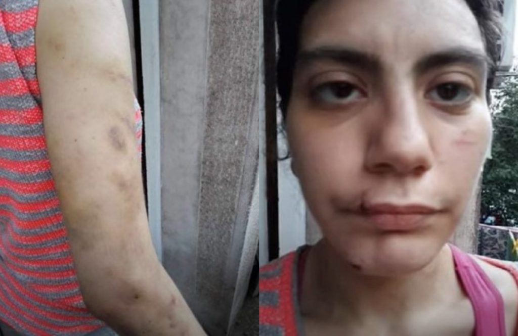 Φαίη Μπακογιώργου: Μαρτυρία – σοκ ενός εκ των τριών παιδιών της 23χρονης – «Τη χτυπούσε άγρια μπροστά μου»
