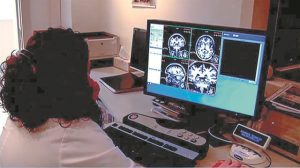 Aνοια – Αλτσχάιμερ: Νέα εξέταση ίσως προβλέπει την εμφάνισή τους έως και εννέα χρόνια πριν τη διάγνωση