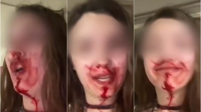 Ενδοοικογενειακή βία: Γυναίκα κατήγγειλε με αίματα στο πρόσωπο τον ξυλοδαρμό από τον σύζυγό της