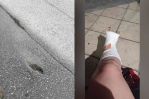 Σοβαρός τραυματισμός γυναίκας λόγω υποχώρησης οδοστρώματος στη Θεσσαλονίκη – «Έχω πολλαπλά κατάγματα»