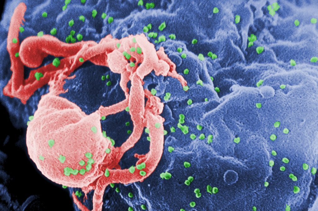 Έβδομη περίπτωση ασθενoύς που δείχνει να θεραπεύτηκε πλήρως από τον HIV
