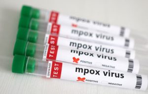 Mpox: Εντοπίστηκε το πρώτο κρούσμα του παραλλαγμένου στελέχους στον Καναδά